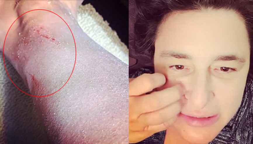 Esra Dermancıoğlu hastalığını açıkladı