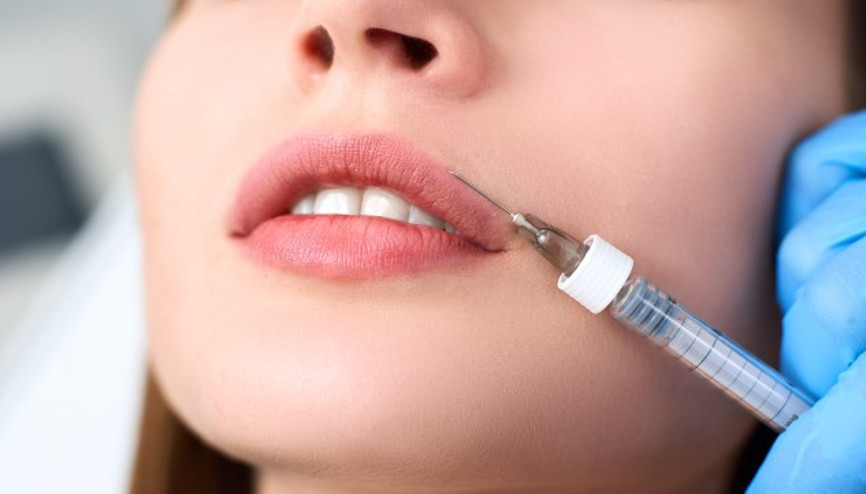 Lip Lifting mi, Dudak Dolgusu mu Lip Lifting Nedir Lip Lifting mi, Dudak Dolgusu mu Lip Lifting Nedir