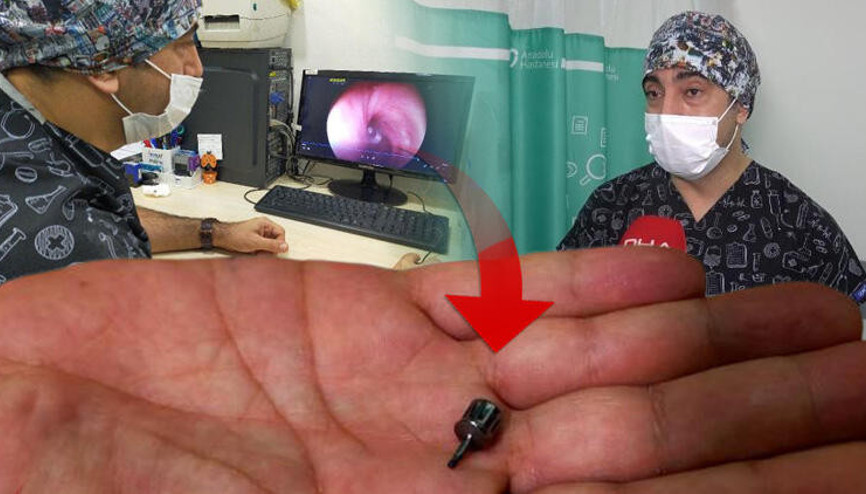 Bursada, gittiği dişçide akciğerine implant parçası kaçtı