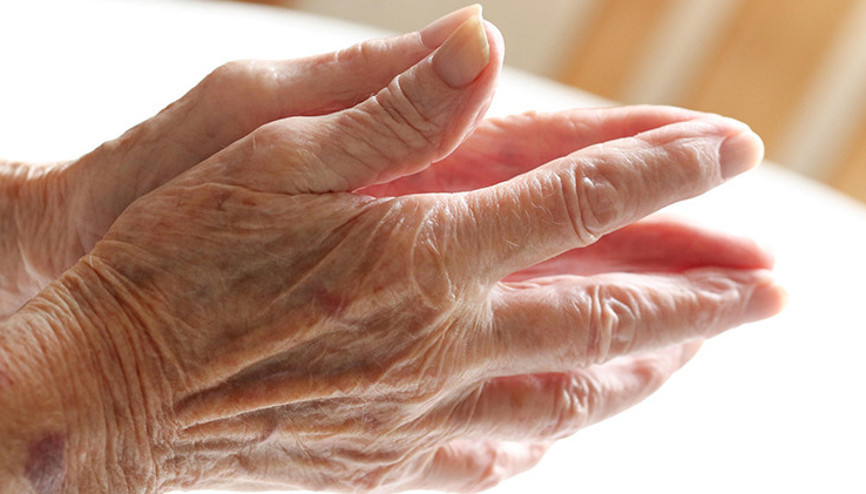 Parkinson Hastalığı Nedir ve Neden Olur