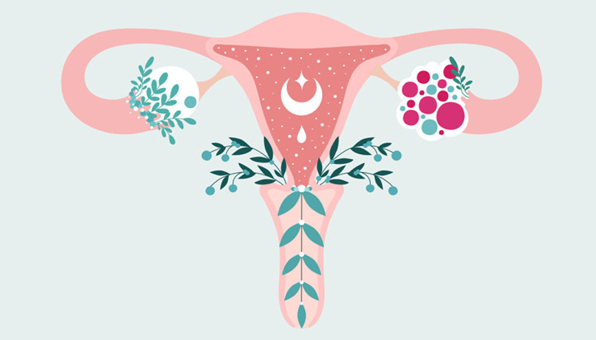 Polikistik Over Sendromu Tanısı Aldım: Beni Neler Bekliyor