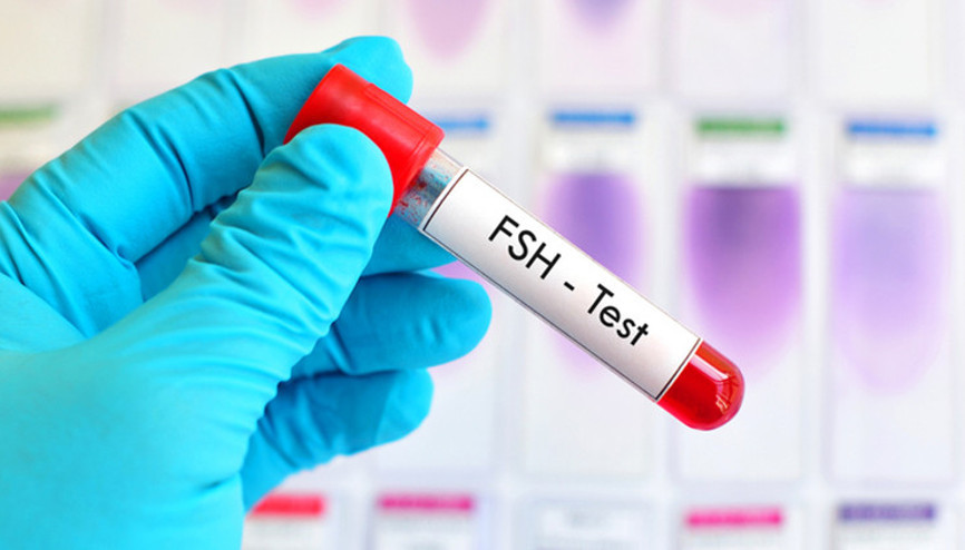 Erkeğe bağlı kısırlık durumunda FSH hormonunun önemi Erkeğe bağlı kısırlık durumunda FSH hormonunun önemi