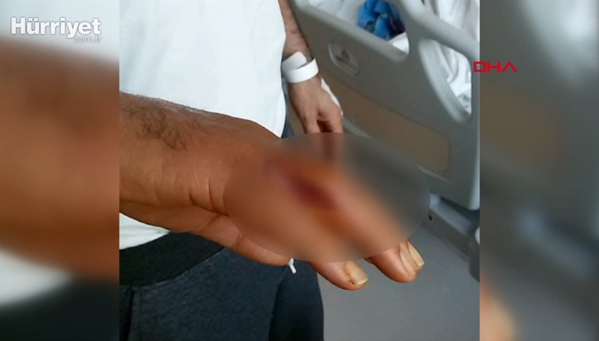 Eline batan kürdan kabusu oldu; arkadaşlarımı arayıp helallik istedim