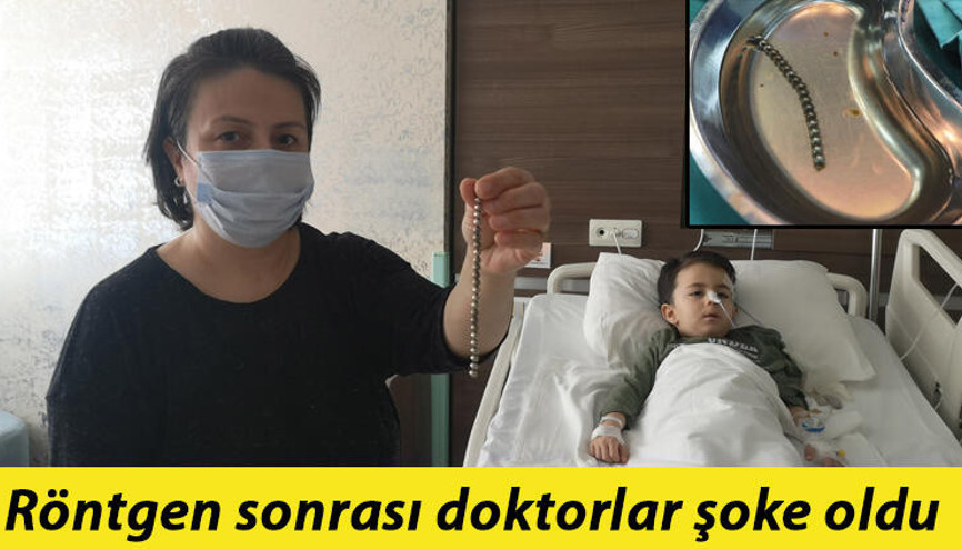 Küçük çocuğun bağırsağından çıkanlar şaşkına çevirdi