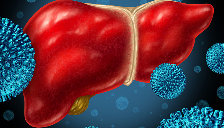 Karaciğer yağlanması nedir, neden olur Karaciğer yağlanmasında bu belirtilere dikkat
