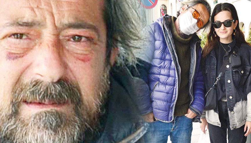 Feridun Düzağaçın son hali dikkat çekti: Dayak yedim