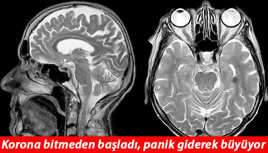 Korona salgını bitmeden başladı... Kanadada gizemli beyin hastalığı panik yarattı