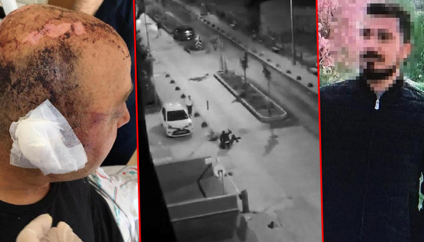 Görüntüler olay olmuştu Eskişehirde telsizle dövülen polis: Gözlerimi bir gün sonra açtım