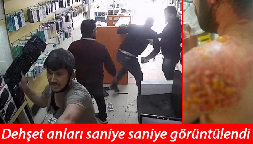Antalyada akılalmaz olay Kardeşimizden boşan diyerek eniştesini öldüresiye dövdüler Antalyada akılalmaz olay Kardeşimizden boşan diyerek eniştesini öldüresiye dövdüler