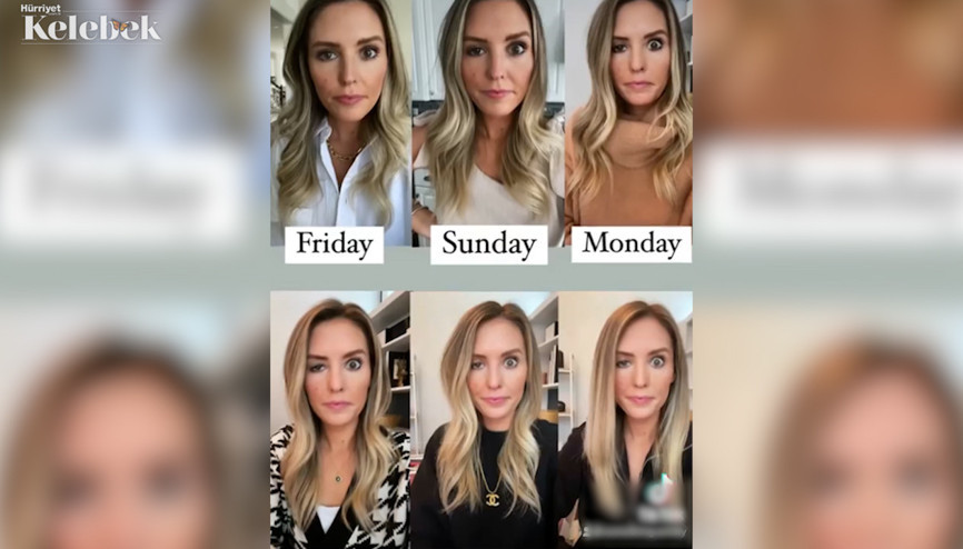 Botoks yapılırken terslik oldu