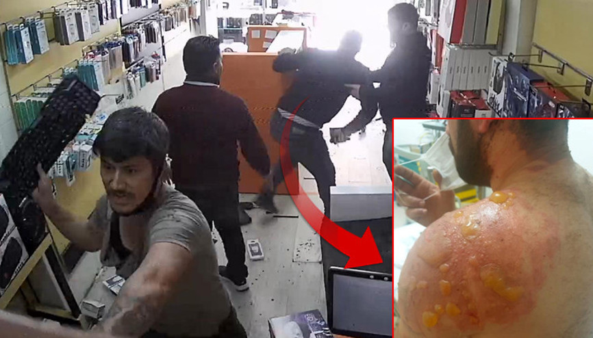 Kardeşimizden boşan diyerek eniştesini öldüresiye dövmüşlerdi... Akılalmaz olayda yeni gelişme Kardeşimizden boşan diyerek eniştesini öldüresiye dövmüşlerdi... Akılalmaz olayda yeni gelişme