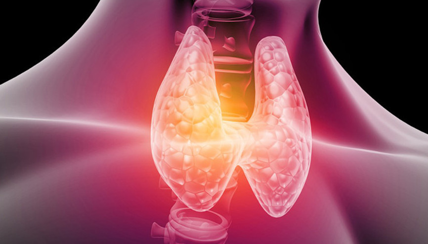 Hipertiroidi nedir, belirtileri nelerdir İşte hipertiroidi tedavisi hakkında merak edilenler