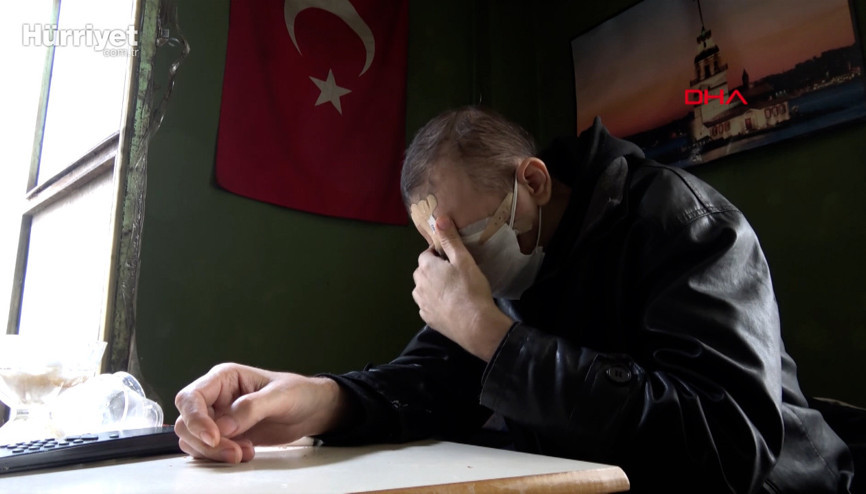 Cilt kanserinden yüzünü kaybeden baba: Kızımı öpmeyi çok özledim