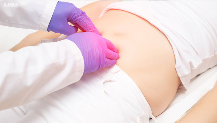 Kasık fıtığı için erkekler risk altında