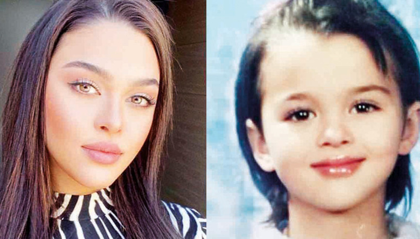 Aslıhan Karalardan estetik iddialarına fotoğraflı yanıt