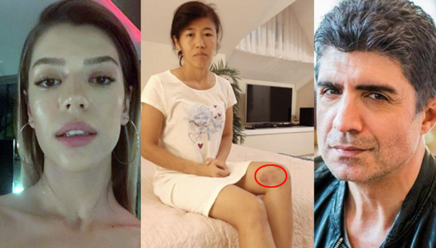 Feyza Aktan oğlu Kuzeyin bakıcısını darp mı etti