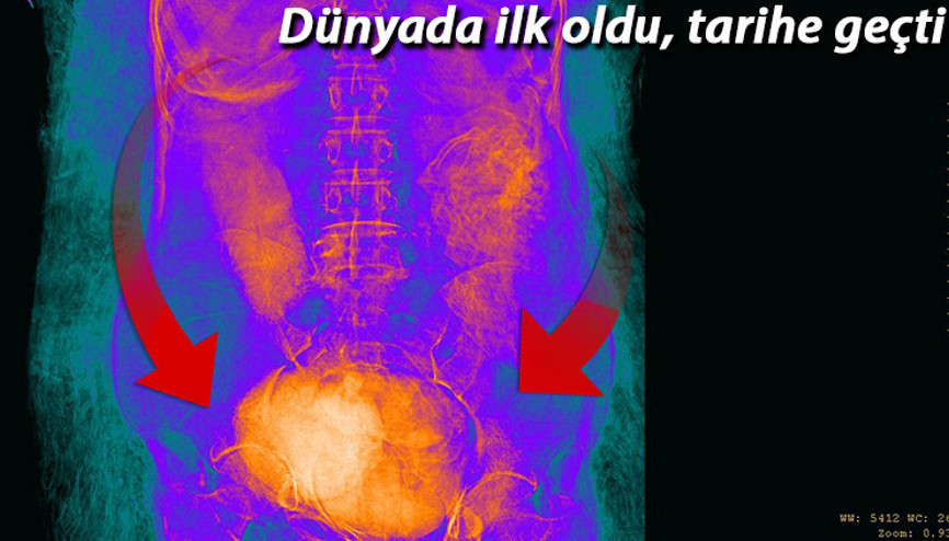Dünyada bir ilk Hamile bir kadına ait antik Mısır mumyası bulundu