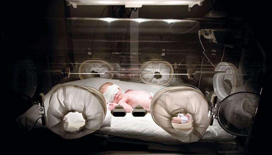 Prematüre bebeklerde körlük tehlikesi