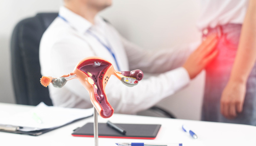 Miyom nedir Miyom nedir