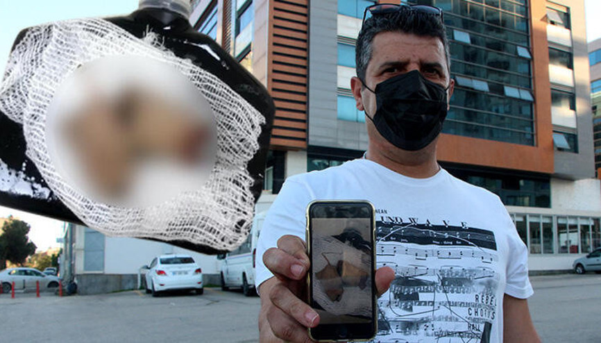 Elinde havai fişek patladı, parmakları koptu Sahibini sosyal medyada aradı