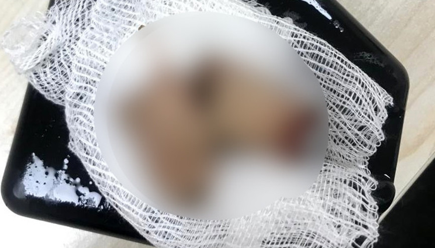 Şampiyonluk kutlamasında havai fişek elinde patlayınca parmakları parçalandı