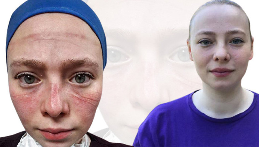 Salgınla savaşan sağlıkçıların simgesi olmuştu Hemşire Seher Altuncu konuştu...