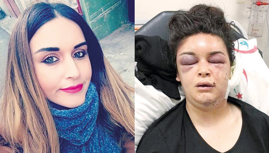 İşkenceye mütalaa