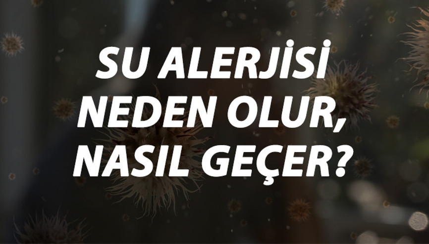 Su Alerjisi Nedir, Neden Olur Ve Nasıl Geçer Su Alerjisi Belirtileri Ve Tedavisi Hakkında Bilgi
