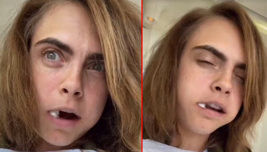 Cara Delevingne, operasyon koltuğundan seslendi: Çok ağladım