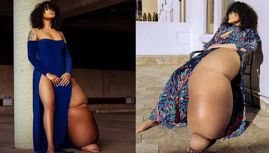 İlham verici bir hikaye | Sol bacağı tam 45 kilo olan model: Mahogany Geter