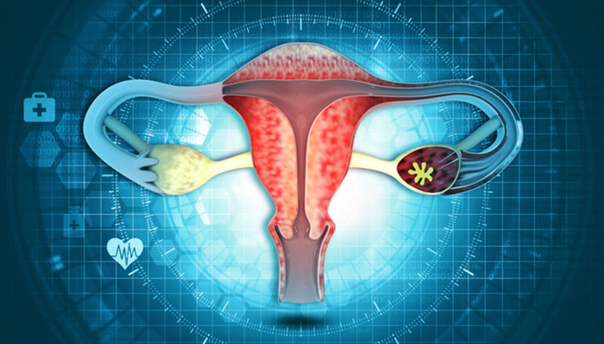 Miyom Belirtileri Nelerdir, Neden Olur Miyom Hakkında Merak Edilenler