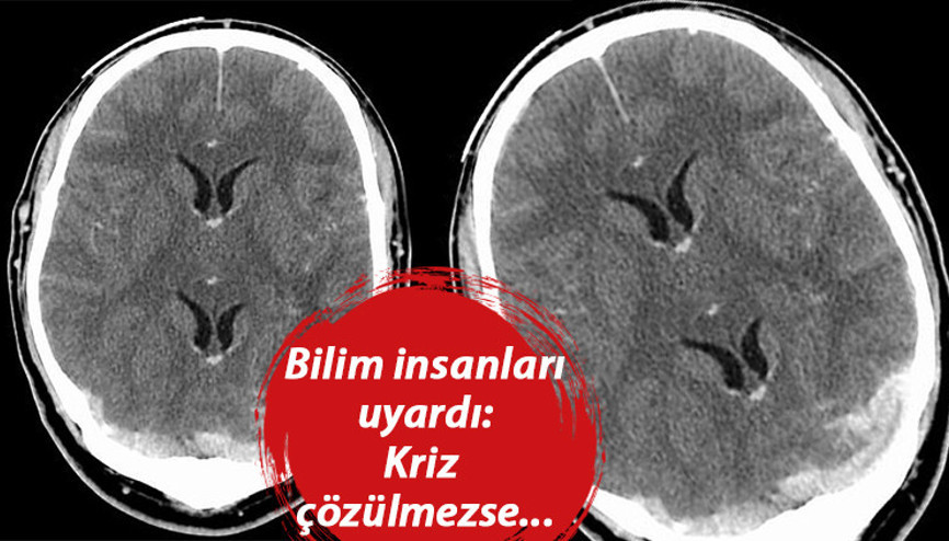 Bilim insanları korkunç gerçeği açıkladı: Beyin yiyen amiplerin sayısı artacak