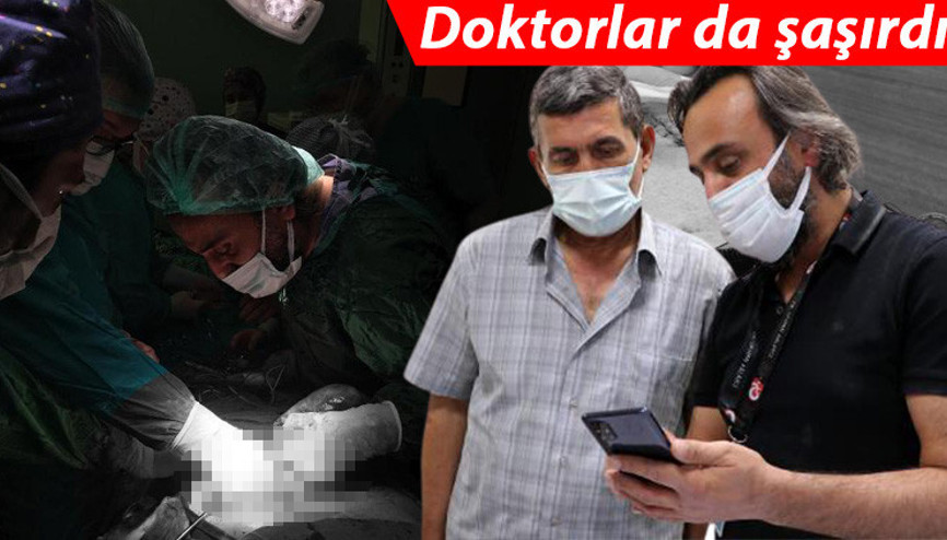 Karın ağrısı şikayetiyle gitti, büyük şok yaşadı Doktorlar da şaşırdı