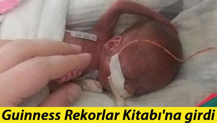 Doktorlar yaşayamaz demişti... Guinness Rekorlar Kitabına girdi