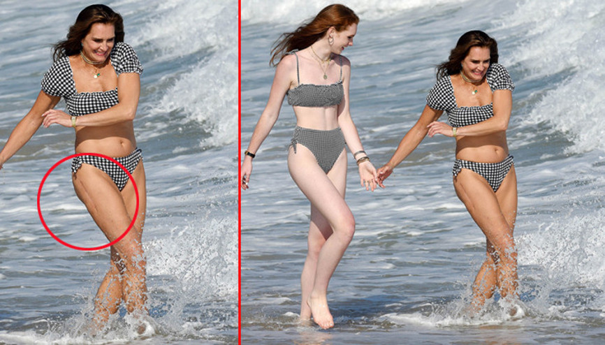 Kızlarıyla poz verdi: Bacağındaki yara izini de saklamadı