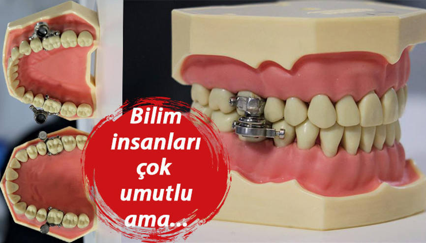 Kilo kontrol cihazına tepki yağıyor... Bunun adı işkence