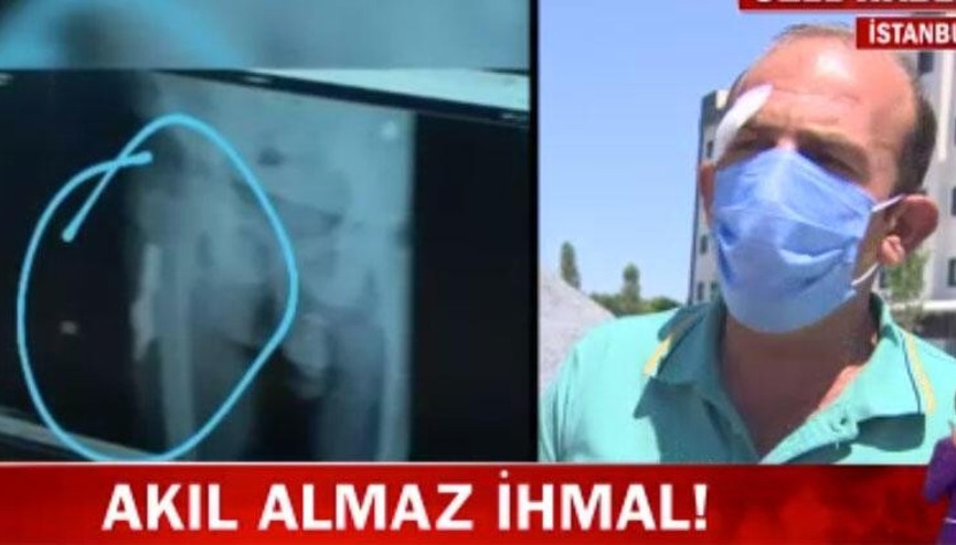 Vücuduna korkuluk demiri saplandı… Geceyi 15 santimetrelik çubukla geçirdi