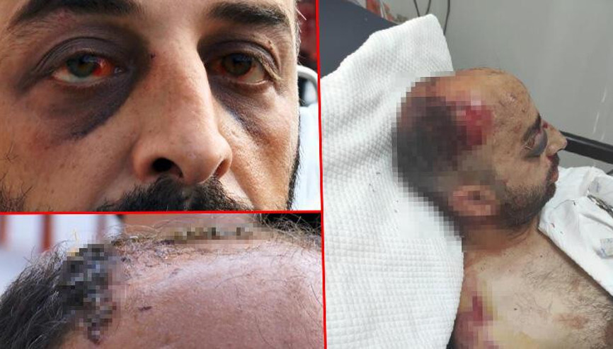 Otomobille çarpıp, öldüresiye dövdüler O anlar kamerada