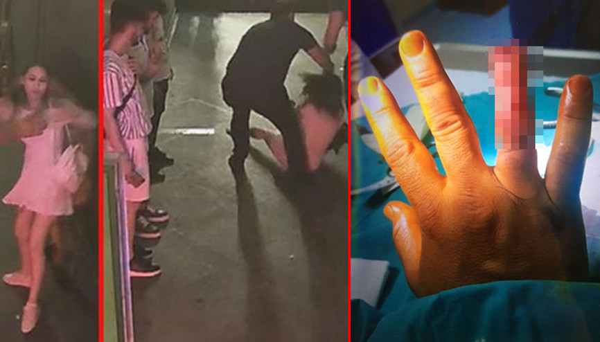 Güvenlik görevlisinin parmağını ısırarak koparmıştı... O turistler ilk kez konuştu