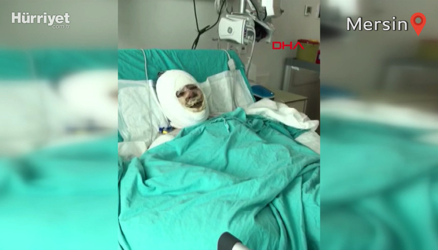 Benzin döküp evi ateşe verdi; alevlerin arasında kalan kayınvalidesi yaralandı