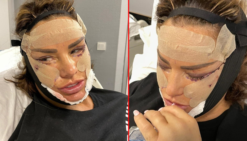 Katie Price estetiğe doyamıyor, eski kocası kızdı: Bari biraz çocuklarını düşün