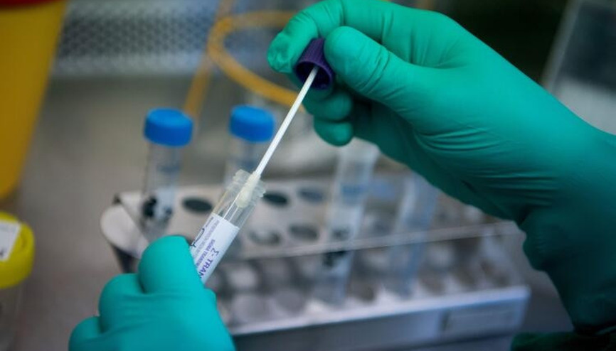 Covid-19 test sonucu ne zaman, kaç günde çıkar E Nabız Koronavirüs (corona virüs) sonuç sorgulama ekranı