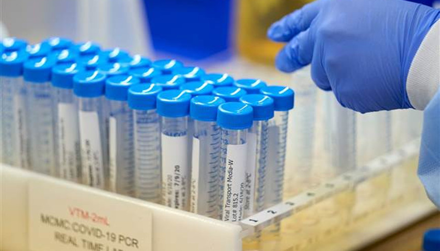 Covid-19 test sonucu ne zaman, kaç günde çıkar E Nabız Koronavirüs (corona virüs) sonuç sorgulama nasıl yapılır İşte detaylar