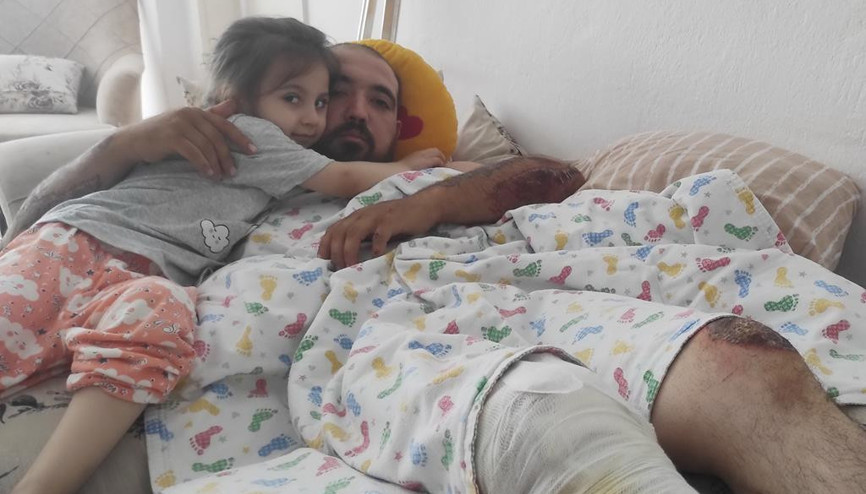 Kaskı sayesinde ölümden döndü Kaskı sayesinde ölümden döndü