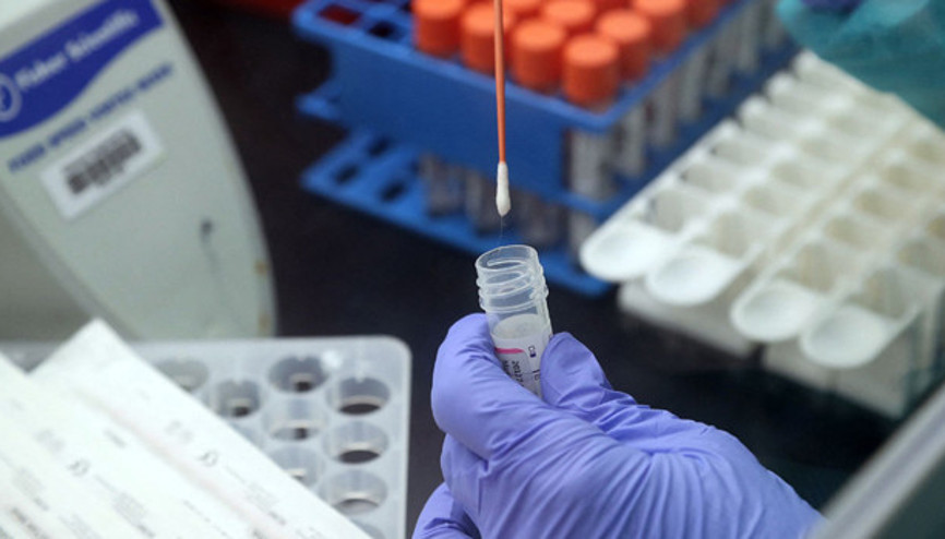 PCR testi kimler için zorunlu, zorunlu testler ücretli mi olacak... İşte merak edilen detaylar