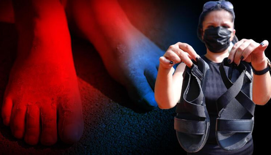 Ayaklarında yara oluşan kadının kimyasal ayakkabı şikayeti