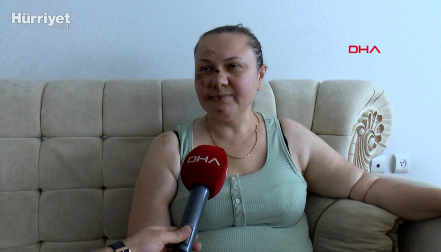 3 çocuk annesi, eski erkek arkadaşı tarafından dövülüp araçtan atıldı