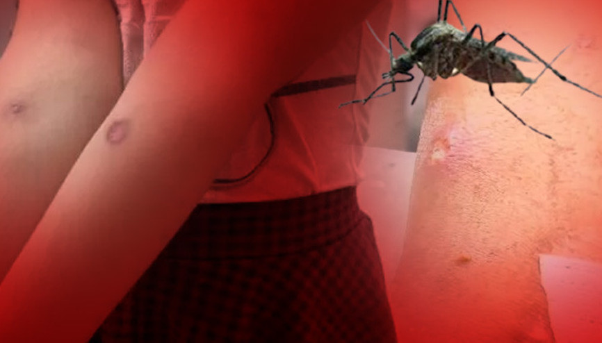 Sivrisinek tehlikesi 3 ölümcül hastalık riski var: Bu belirtilere dikkat