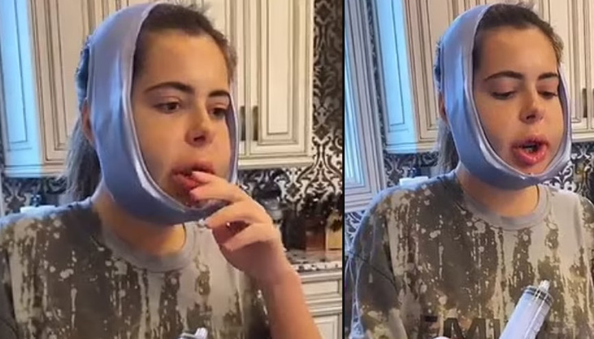 TV yıldızı Brielle Biermann bıçak altına yattı: Pizza yemek için gün sayıyorum