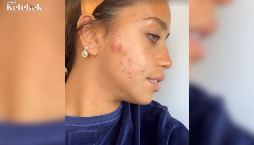 Zeynep Alkan: Özgüvenim sıfır, dışarı bile çıkmak istemiyorum